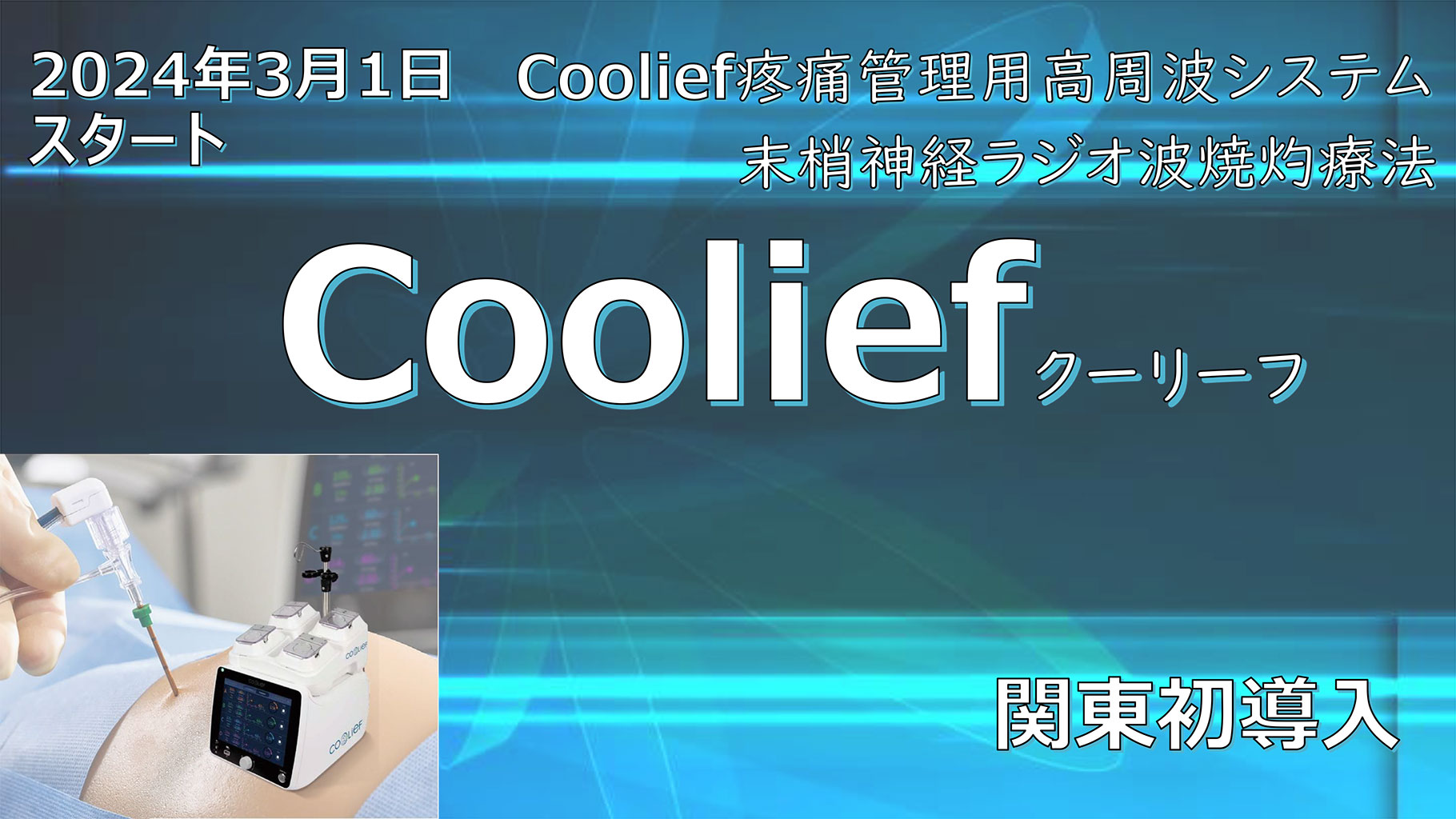 2024年3月1日スタートCoolief疼痛管理用高周波システム末梢神経ラジオ波焼灼療法