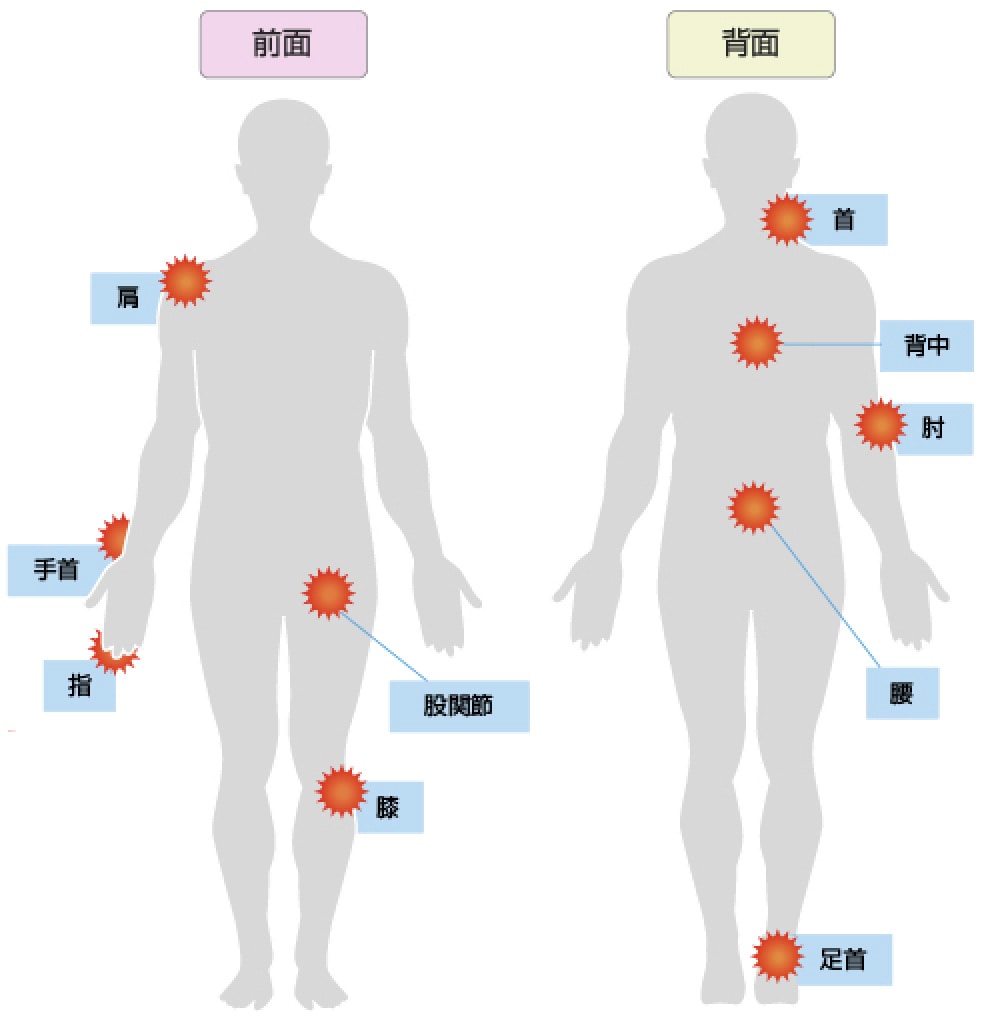 図: 整形外科の対象となる症状など