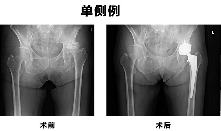 片側例